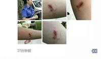 女子爆料城管打人视频大全